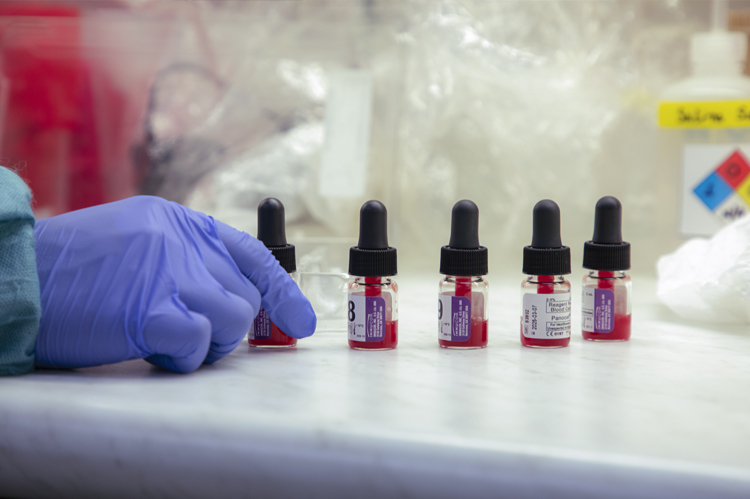 CLS student's glove handling blood vials in lab.